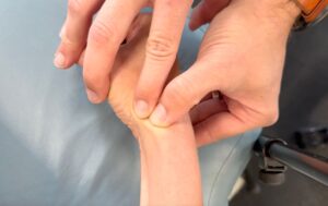 Dr. John demonstrating cross friction massage by applying moderate pressure and moving in a perpendicular motion to break up scar tissue